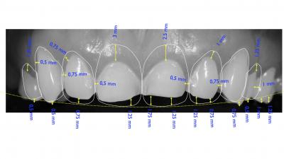 Advanced denta treatments | Stanhope Place Dental Practice W2